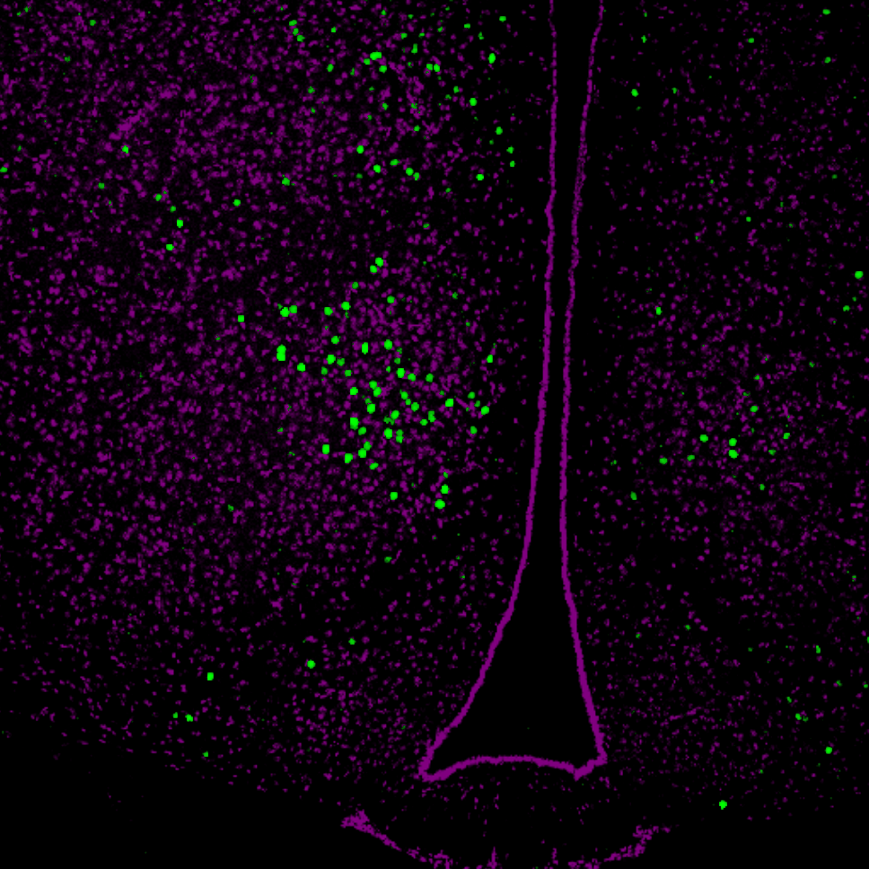 Células ativadas no núcleo ventromedial do hipotálamo (VMH) após exposição do animal a odores específicos (marcação em verde).