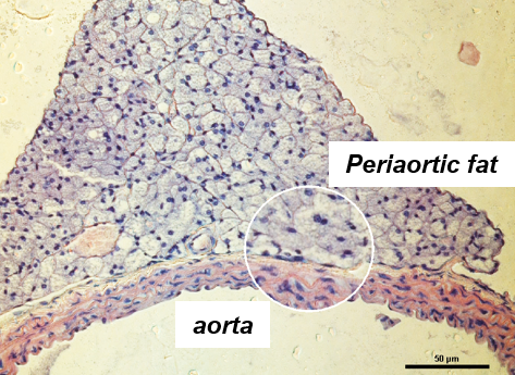 Corte transversal da aorta de camundongo com o tecido adiposo perivascular adjacente